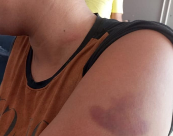 Preso confessou à polícia que agrediu a companheira com socos na cabeça numa briga por ciúmes