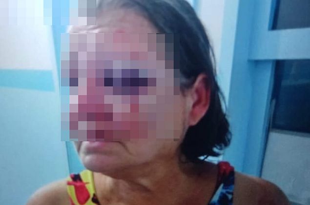Polícia pede prisão preventiva de filho suspeito de espancar a própria mãe, em Campo Alegre