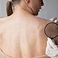 Brasil deve registrar 704 mil novos casos de câncer de pele em 3 anos