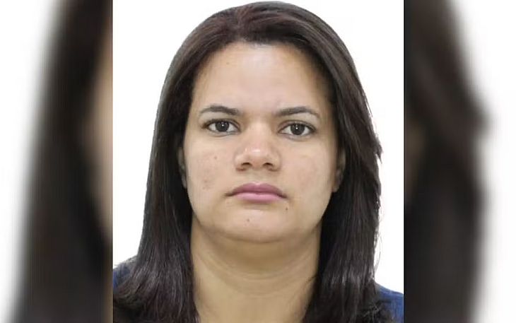 Mileide Mirela Soledade Paim, 36 anos, teve várias queimaduras pelo corpo