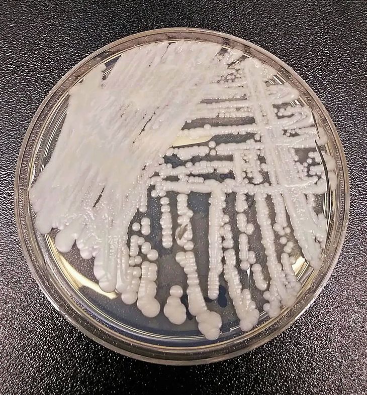O fungo Candida auris ataca pessoas com seu sistema imunológico debilitado