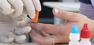 Ministério da Saúde orienta farmácias a realizar testes rápidos de HIV