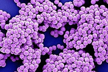 Os óbitos pela bactéria MRSA passaram de 57,2 mil em 1990 para 130 mil em 2021